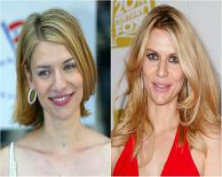 Claire Danes before surgery